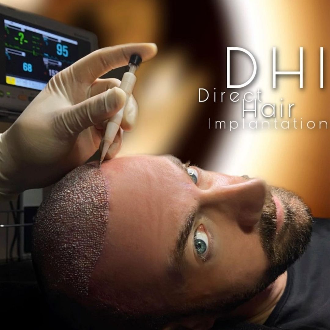 DHI Hair Transplant