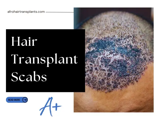 Hair Transplant Scabs
