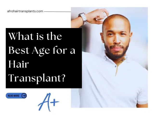 What is the Best Age for a Hair Transplant