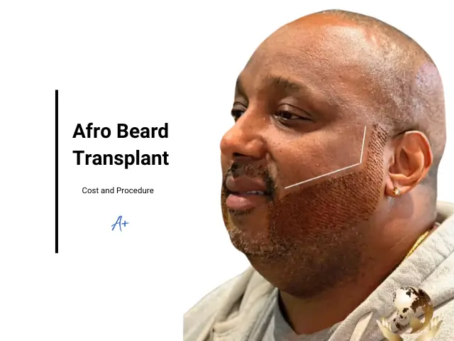 Afro Beard Transplant turkey