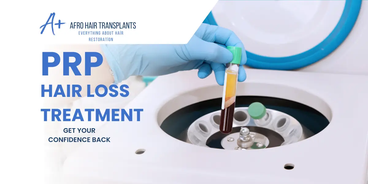 PRP for hair loss Treatment