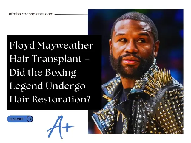 Floyd Mayweather Hair Transplant