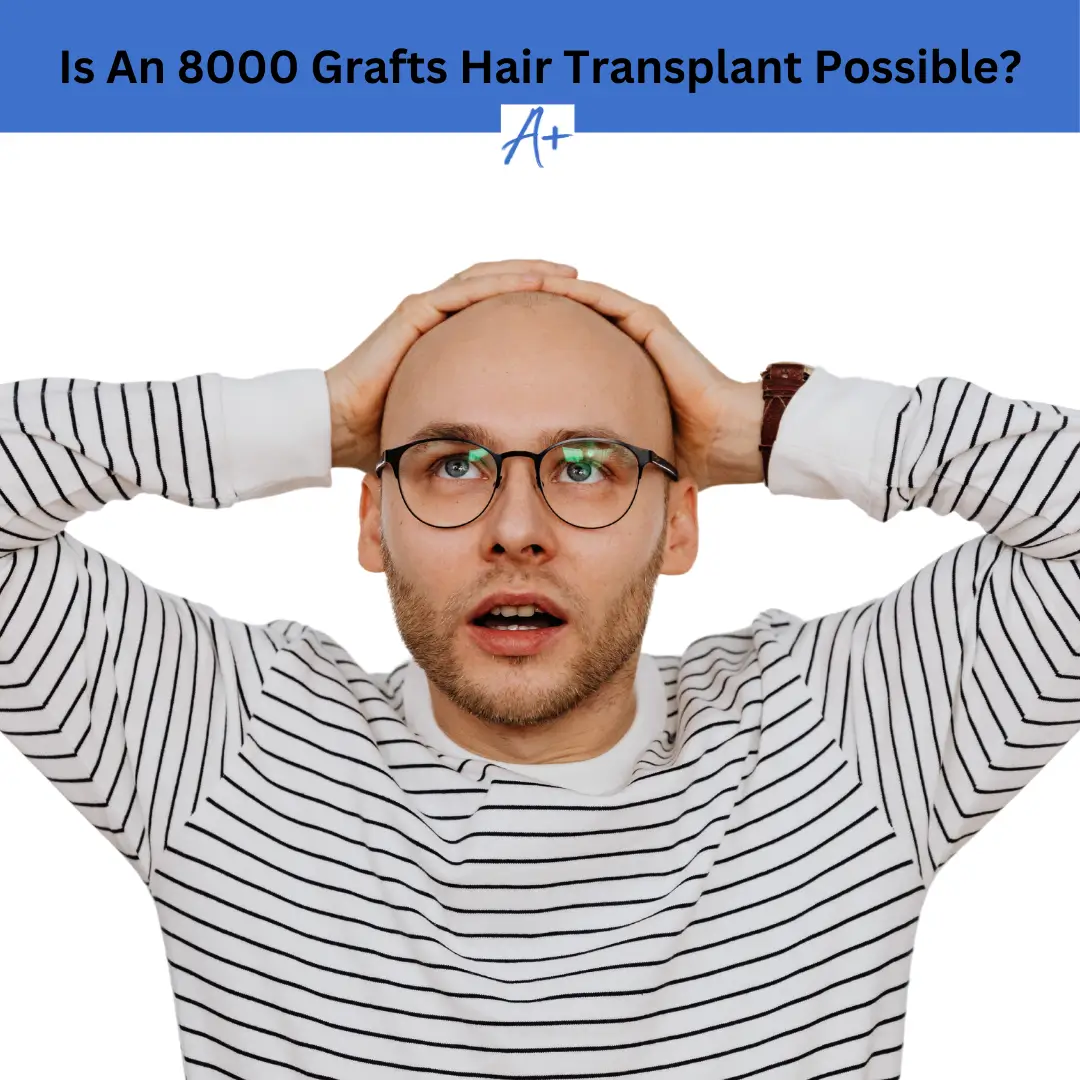 Is An 8000 Grafts Hair Transplant Possible