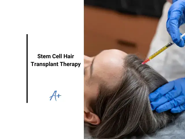 Stem cell hair transplant therapy