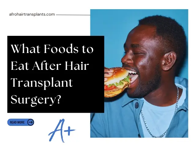 What Foods to Eat After Hair Transplant Surgery