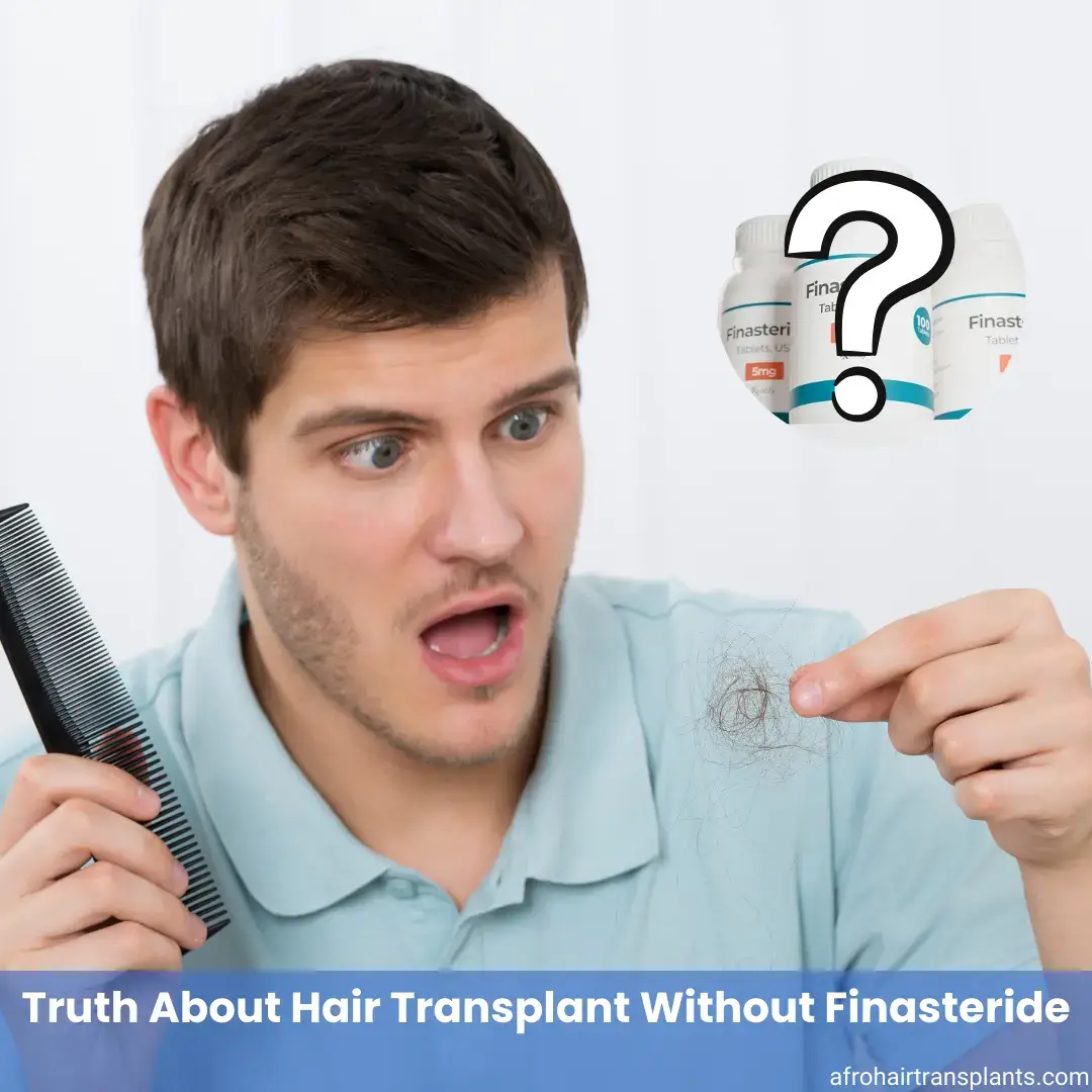 Why Do You Have To Take Finasteride After A Hair Transplant