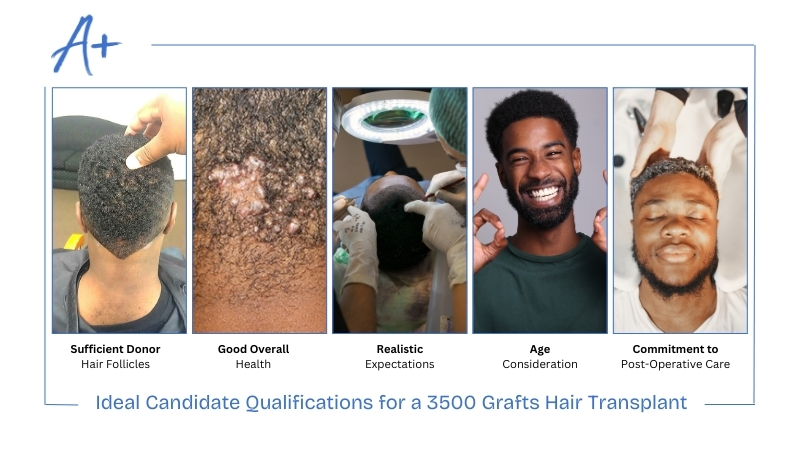 Ideal Candidate Qualifications for a 3500 Grafts Hair Transplant