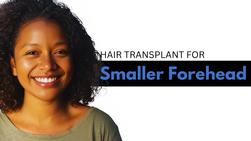 Hair Transplant For Smaller Forehead