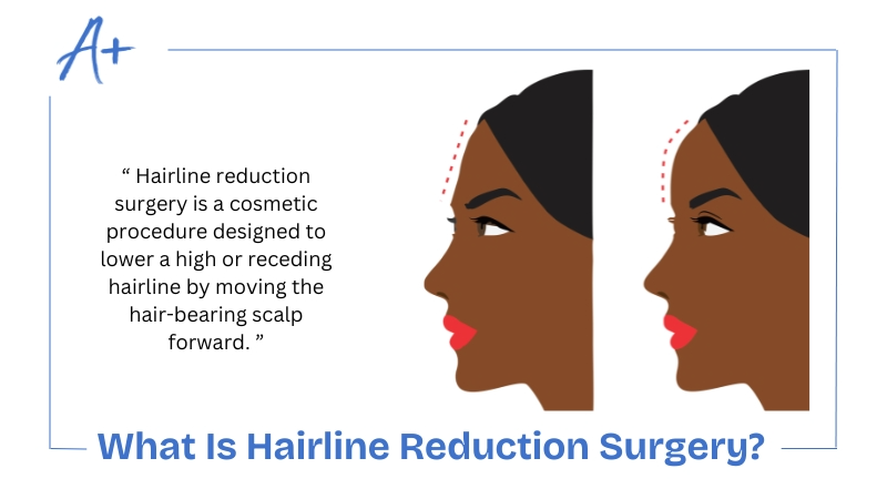 What Is Hairline Reduction Surgery