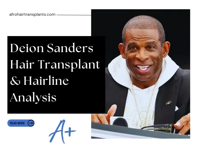 Deion Sanders Hair Transplant & Hairline Analysis