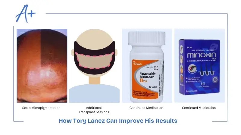 How Tory Lanez Can Improve His Results