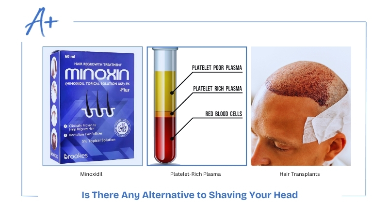 Is There Any Alternative to Shaving Your Head Is There Any Alternative to Shaving Your Head