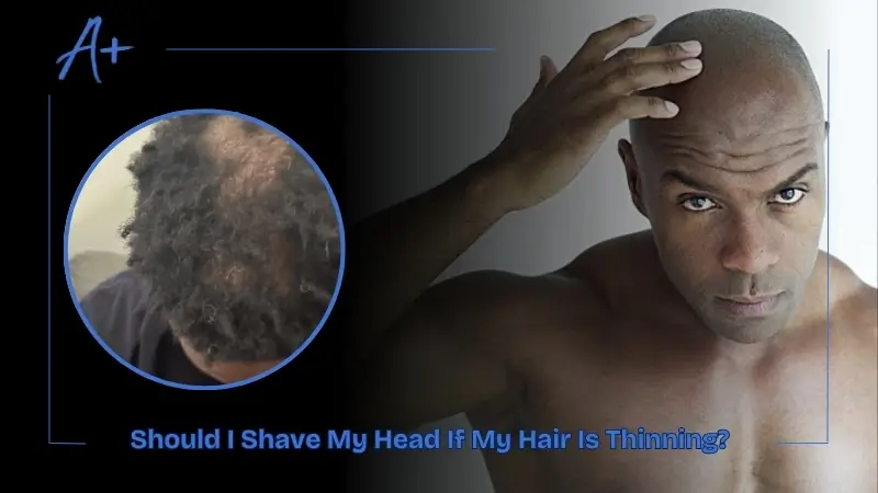 Should I Shave My Head If My Hair Is Thinning Should I Shave My Head If My Hair Is Thinning