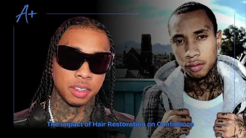 The Impact of Hair Restoration on Confidence