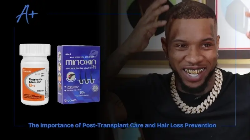 The Importance of Post-Transplant Care and Hair Loss Prevention