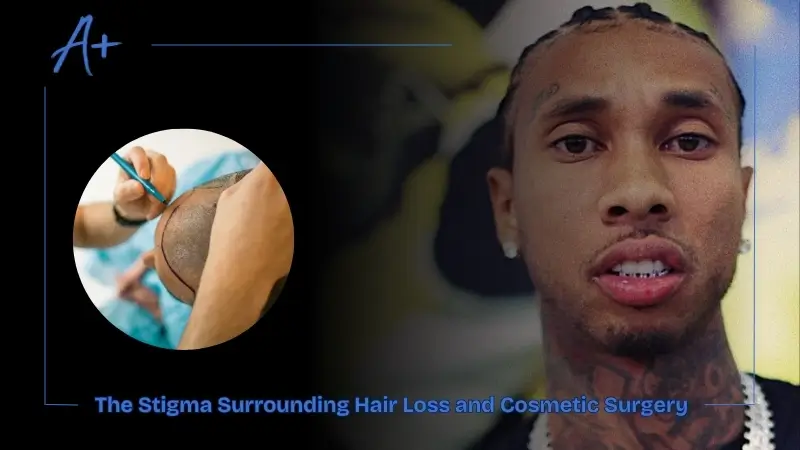 The Stigma Surrounding Hair Loss and Cosmetic Surgery