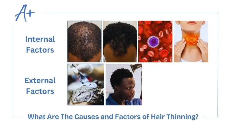 What Are The Causes and Factors of Hair Thinning What Are The Causes and Factors of Hair Thinning