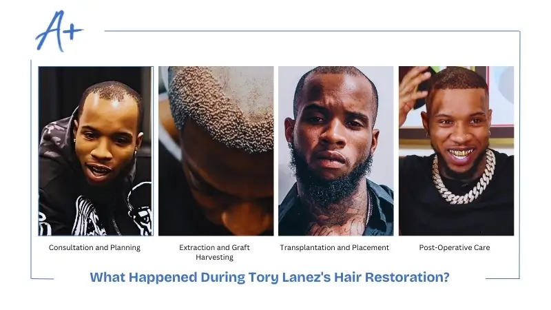 What Happened During Tory Lanez's Hair Restoration