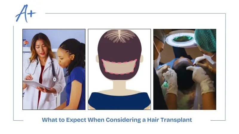 What to Expect When Considering a Hair Transplant