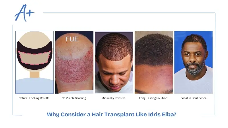 Why Consider a Hair Transplant Like Idris Elba