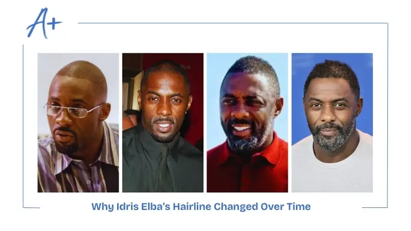 Why Idris Elba’s Hairline Changed Over Time