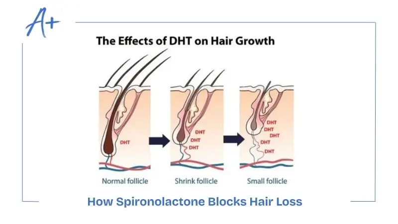 How Does Spironolactone Work for Hair Loss