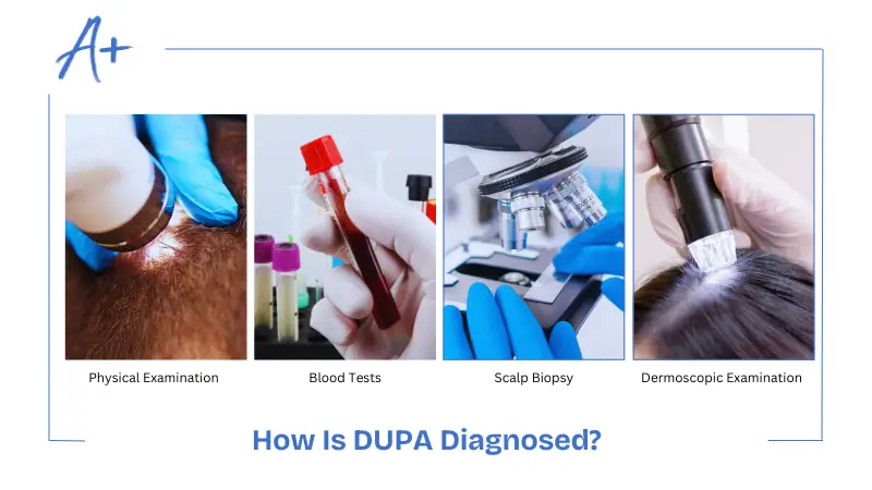 How Is DUPA Diagnosed How Is DUPA Diagnosed