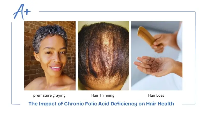 The Impact of Chronic Folic Acid Deficiency on Hair Health