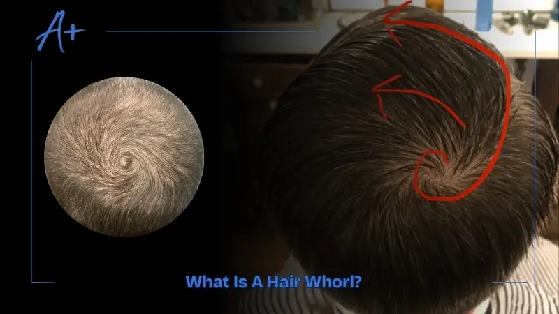 What Is A Hair Whorl