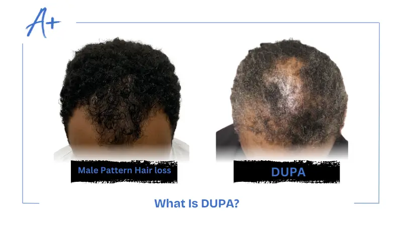 What Is DUPA What Is DUPA