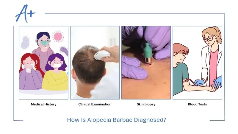 How Is Alopecia Barbae Diagnosed