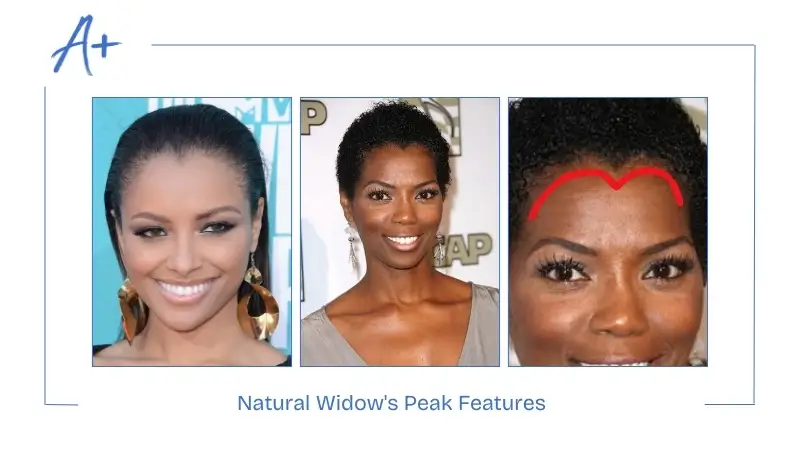 Natural Widow's Peak Features Natural Widow's Peak Features