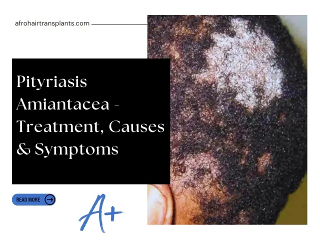 Pityriasis Amiantacea