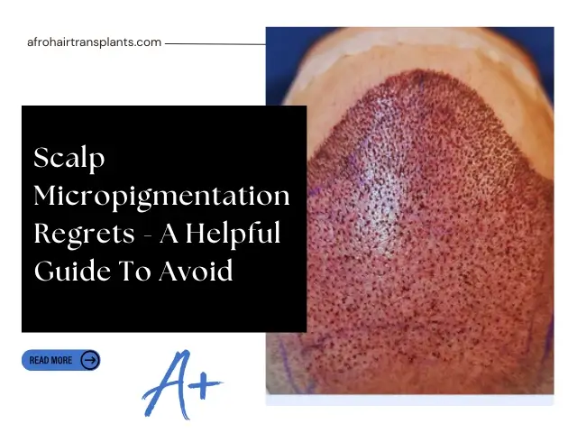Scalp Micropigmentation Regrets