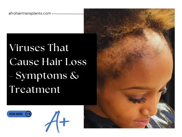 Viruses That Cause Hair Loss