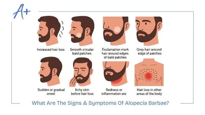 What Are The Signs & Symptoms Of Alopecia Barbae