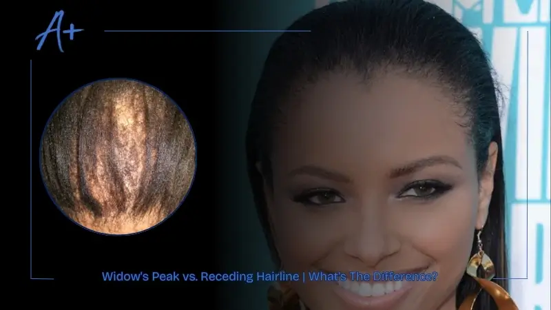 Widow's Peak vs. Receding Hairline What's The Difference Widow's Peak vs. Receding Hairline What's The Difference