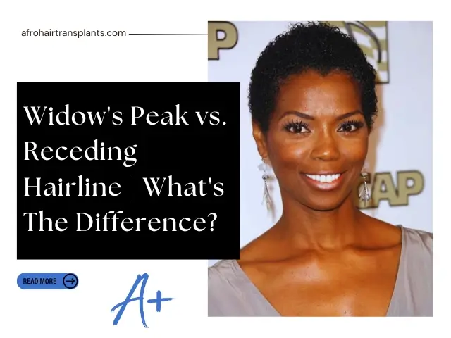 Widow's Peak vs. Receding Hairline